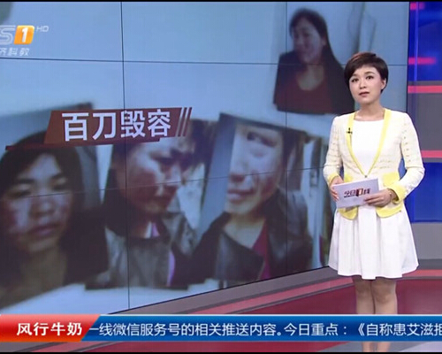 毁容母亲公益救助 广州华美免费修复